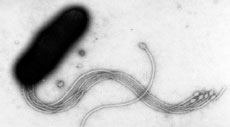 Hpylori